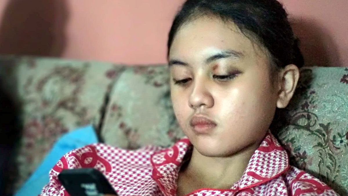 Cahayu Nur Dewata, salah seorang korban selamat tragedi Kanjuruhan (foto: blok-a.com/Putu Ayu)