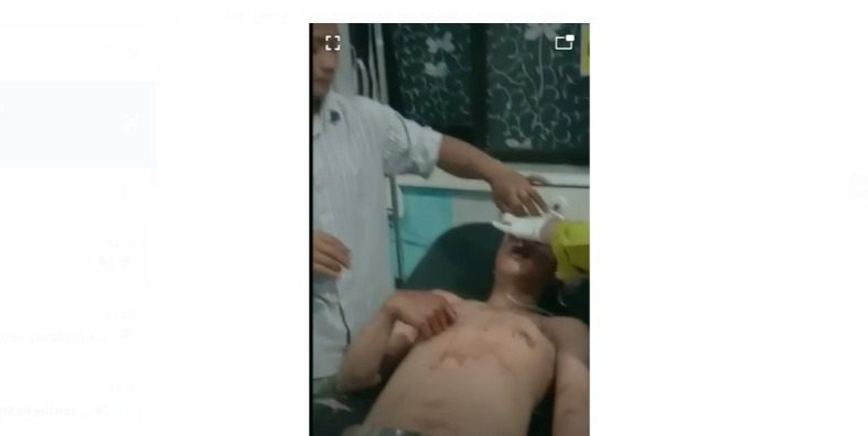 Gegara Istri Siri, Empat Pria di Pujon Malang Luka-Luka karena Adu Bacok (Whatsapp Grup)