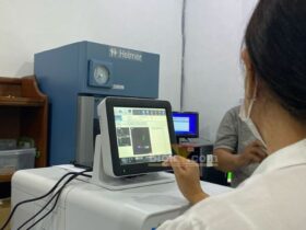 Alat dan sarana prasarana penunjang layanan kesehatan di RSUD Lawang melalui DBHCHT.(blok-a.com/Putu Ayu Pratama S)