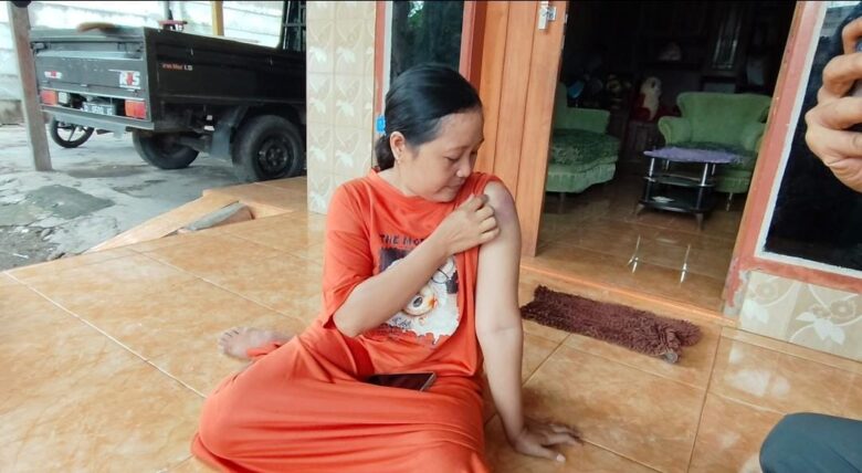 Nur Sofiyah menceritakan insiden yang dialaminya saat menjadi korban begal di Desa Landangan, Kecamatan Kapongan, Situbondo.